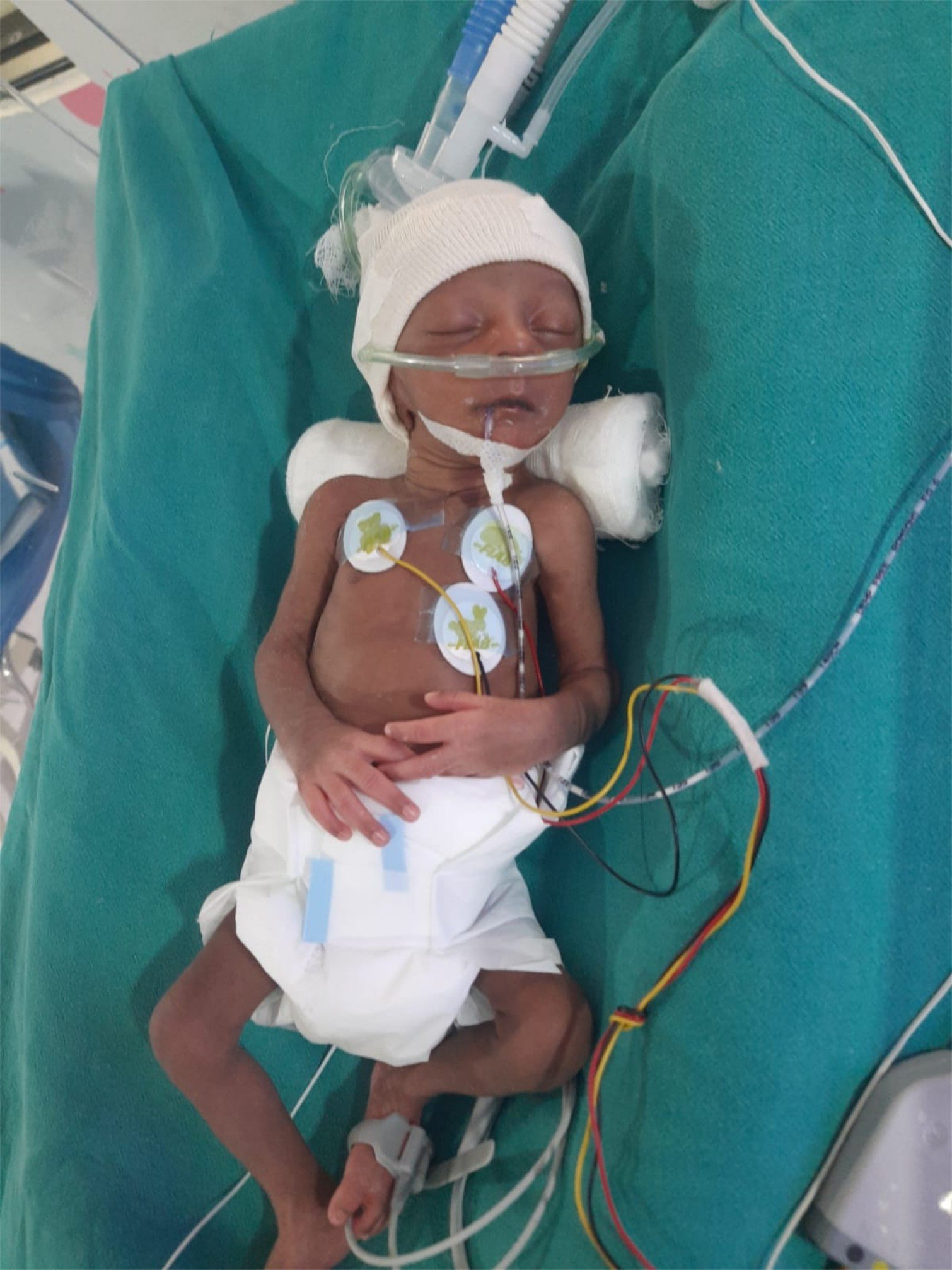 Baby of prema